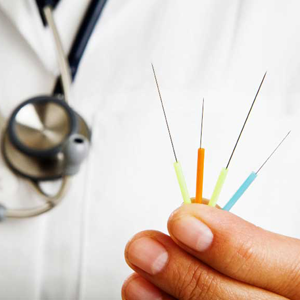 What is Acupuncture & How Does it Work?